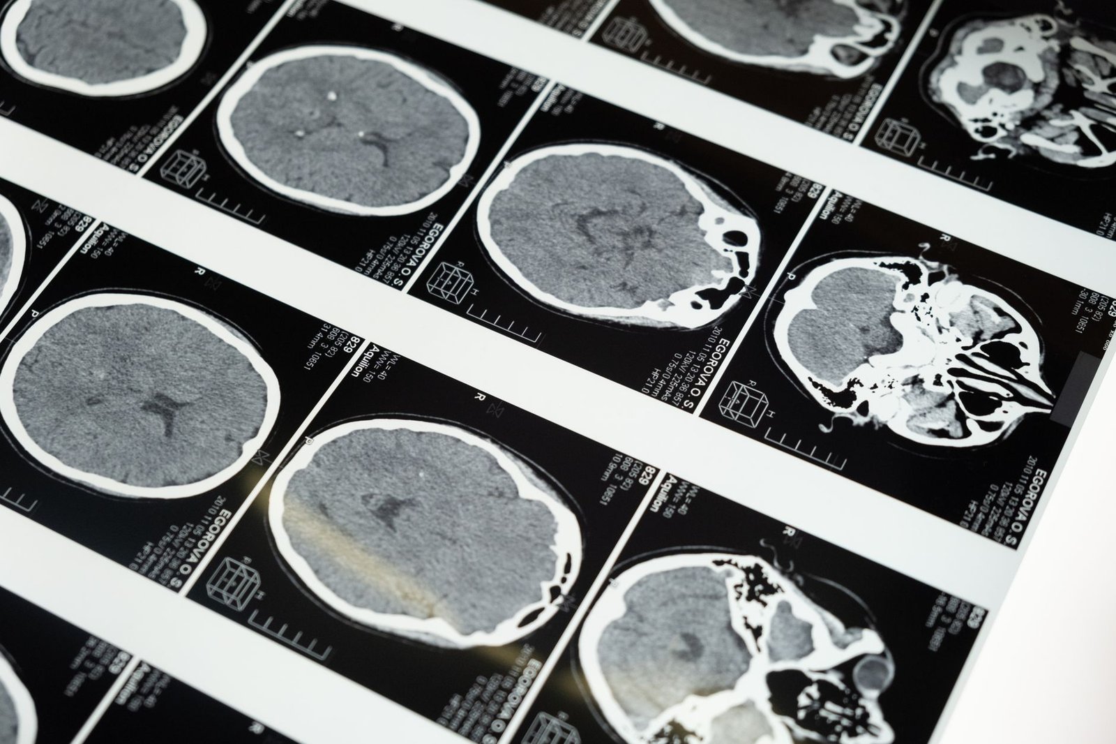 brain cancer worms