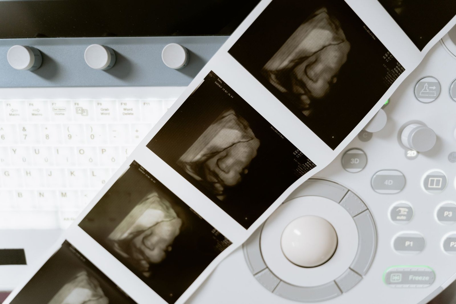 AI diagnoses Boston Children's