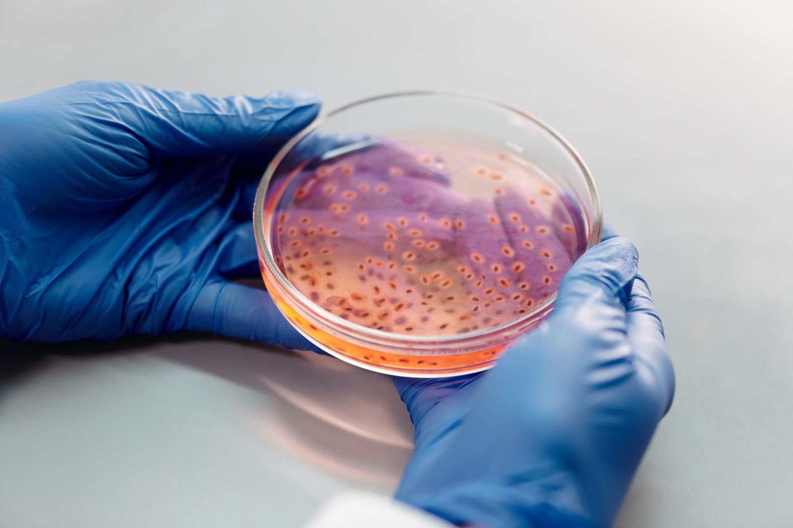 Cyclospora outbreak